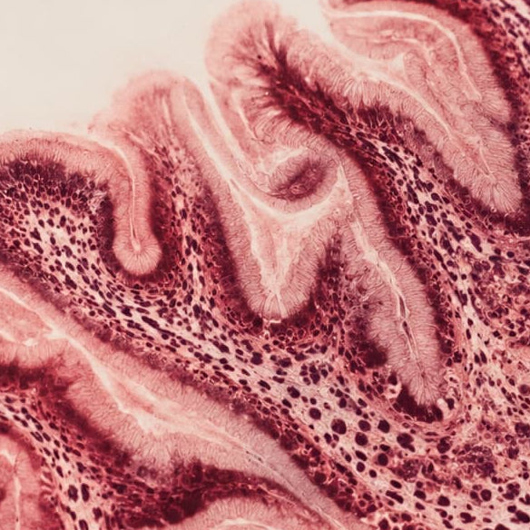 A scientific illustration showing microscopic views of pink and red tissue of vaginal micrbiome